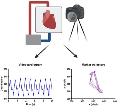 Video analysis of ex vivo beating hearts during preservation on the TransMedics® organ care system